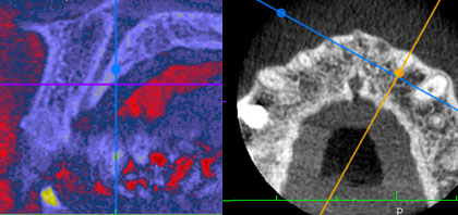 blog-3d-roentgen-color2-dr-marc-hinze-1