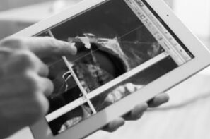 blog-einzelimplantate-dr-marc-hinze-1