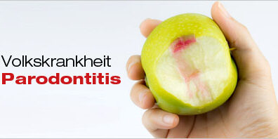 blog-volkskrankheit-parodontitis-dr-marc-hinze
