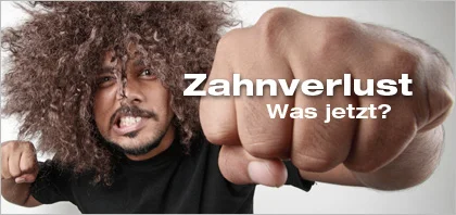 Abgebrochener Zahn - Was tun? | Implanteer