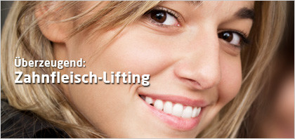 csm_blog-zahnfleisch-lifting-dr-marc-hinze-implantatpraxis_31b8be124a