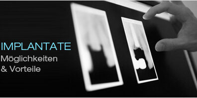 blog-vorteile-implantate-dr-marc-hinze