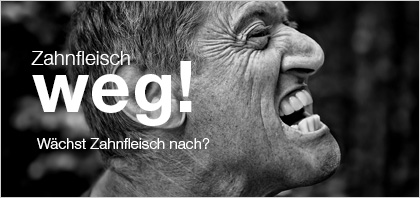 blog-zahnfleisch-weg-dr-marc-hinze