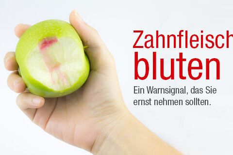 web-Zahnfleischbluten-warnsignal-implanteer