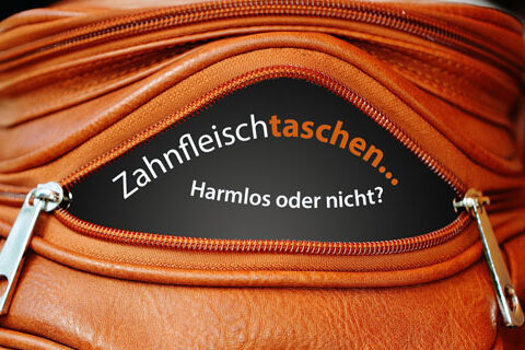 web-zahnfleischtaschen-implanteer