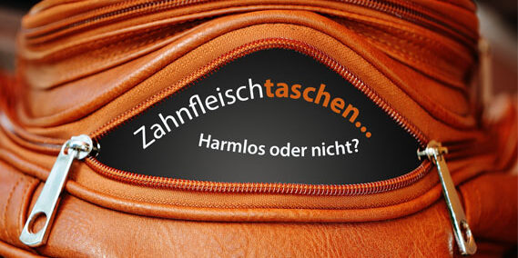 web-zahnfleischtaschen-implanteer