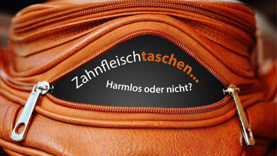 web-zahnfleischtaschen-implanteer zahnfleischtaschen-implanteer