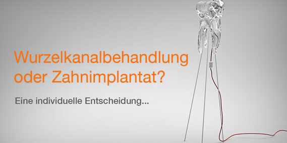 web-wurzelbehandlung-vs-implantat