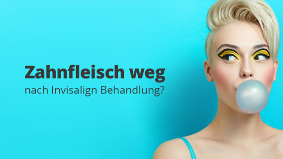 blog-web-Zahnfleisch-weg-implanteer