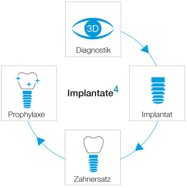 implantate-2-hoch-4-dr-marc-hinze