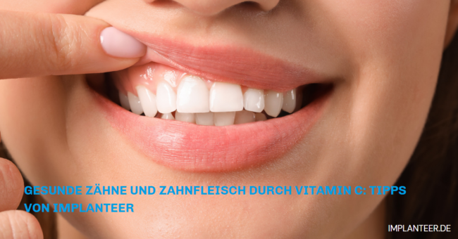 Tipps von Implanteer