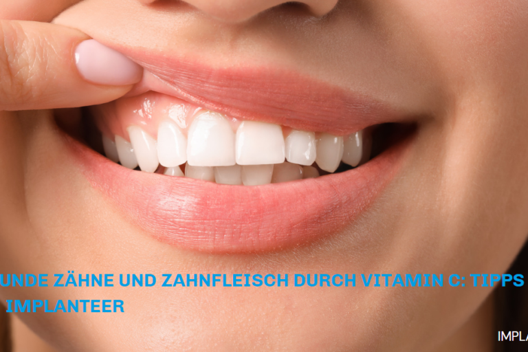 Tipps von Implanteer