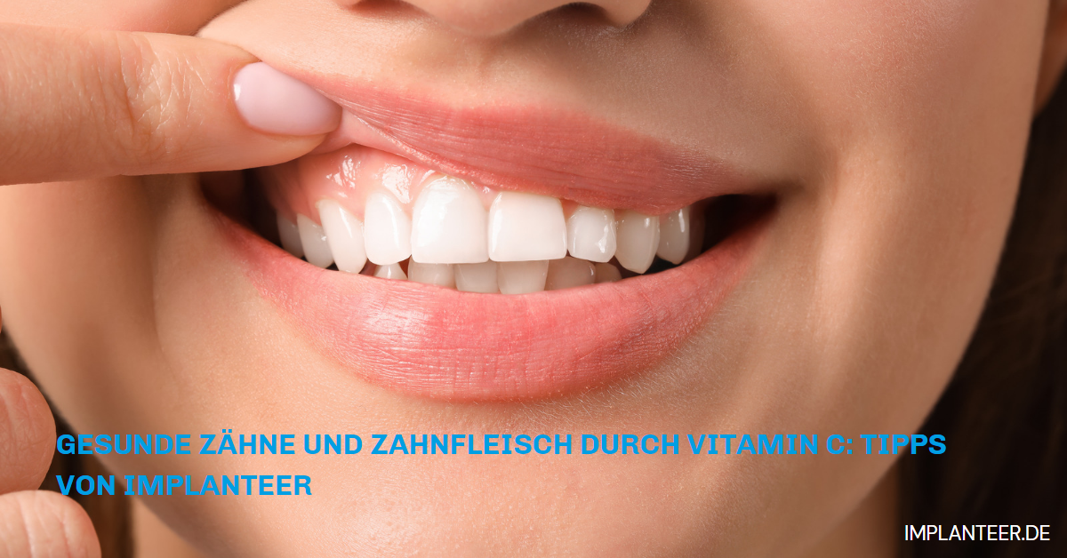 Tipps von Implanteer