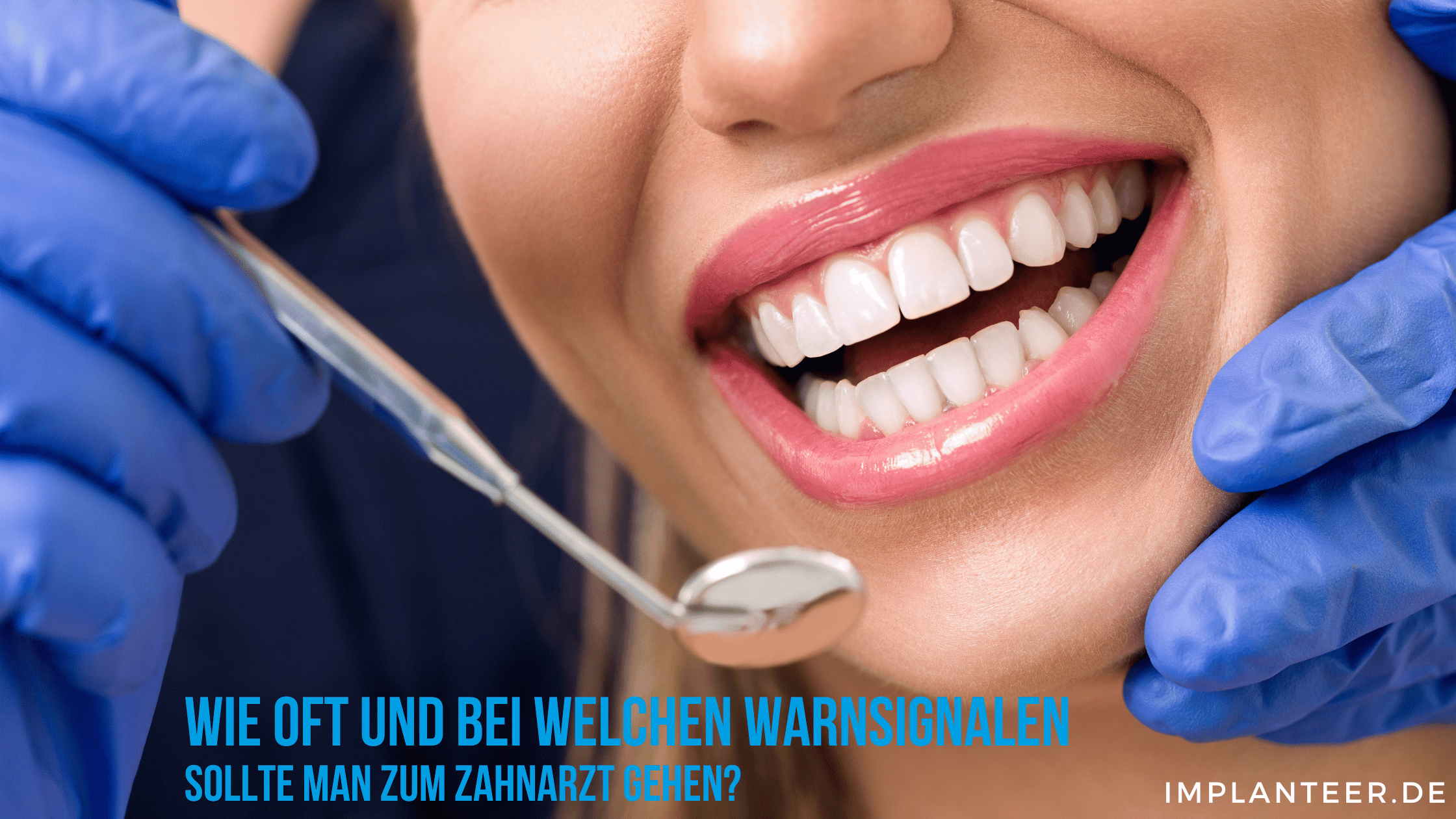 Wie oft und bei welchen Warnsignalen sollte man zum Zahnarzt gehen? Implanteer® Smile is