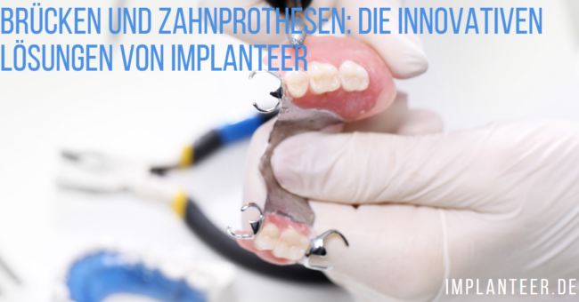 Brücken und Zahnprothesen Brücken und Zahnprothesen: Die innovativen Lösungen von Implanteer