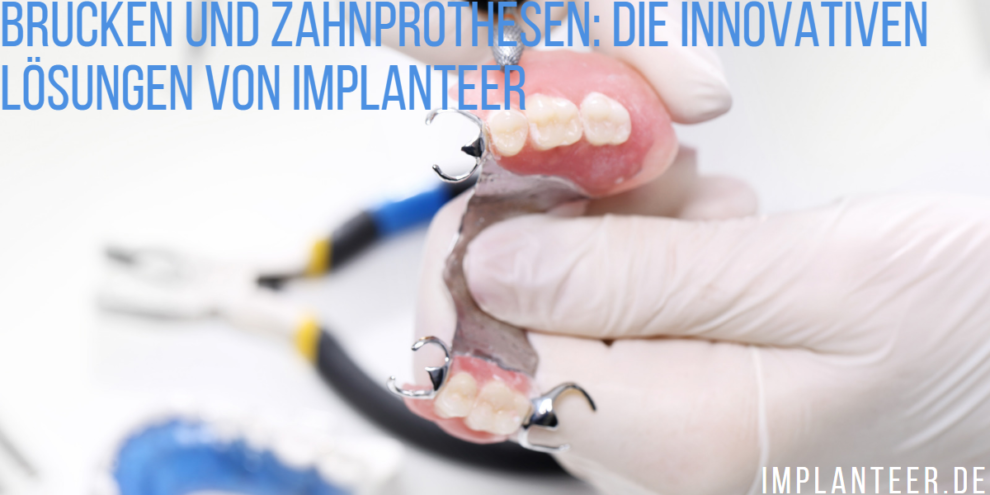 Brücken und Zahnprothesen: Die innovativen Lösungen von Implanteer