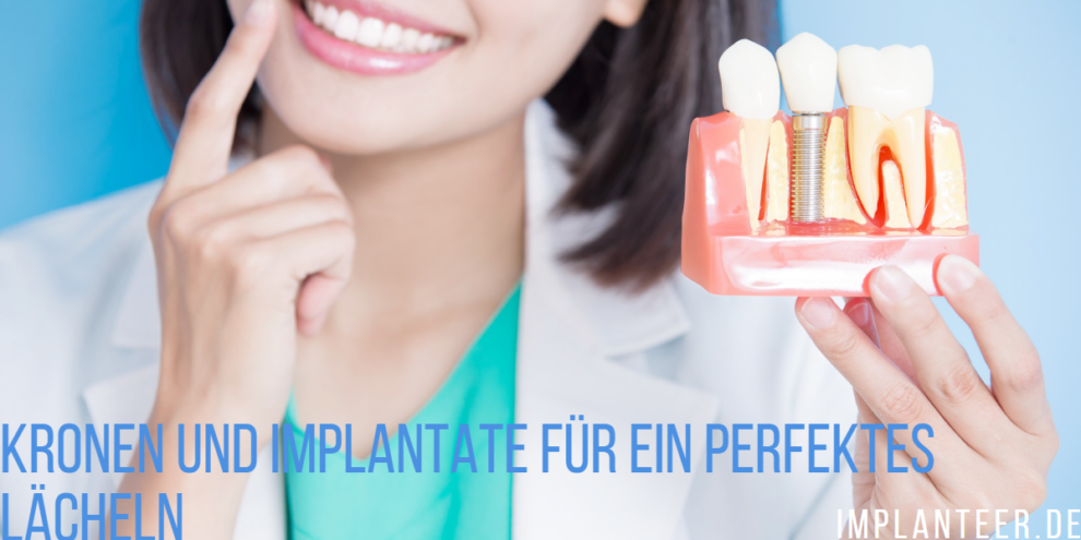 Kronen und Implantate fuer ein perfektes Lächeln