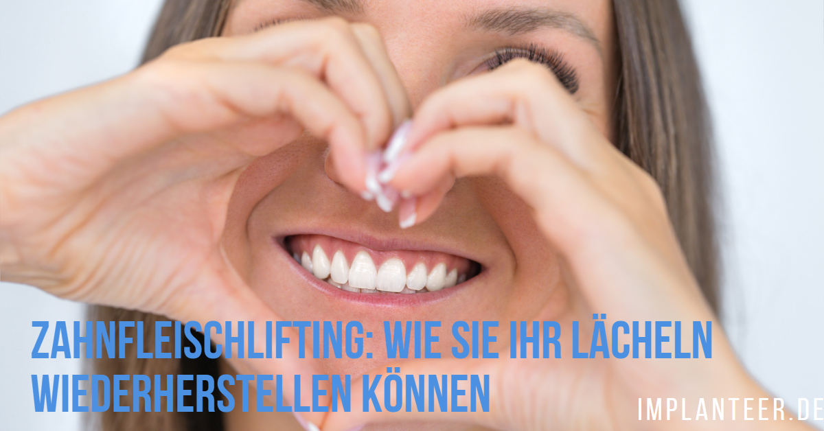Zahnfleischlifting Zahnfleischlifting