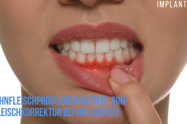 Zahnfleischprobleme Zahnfleischkorrektur