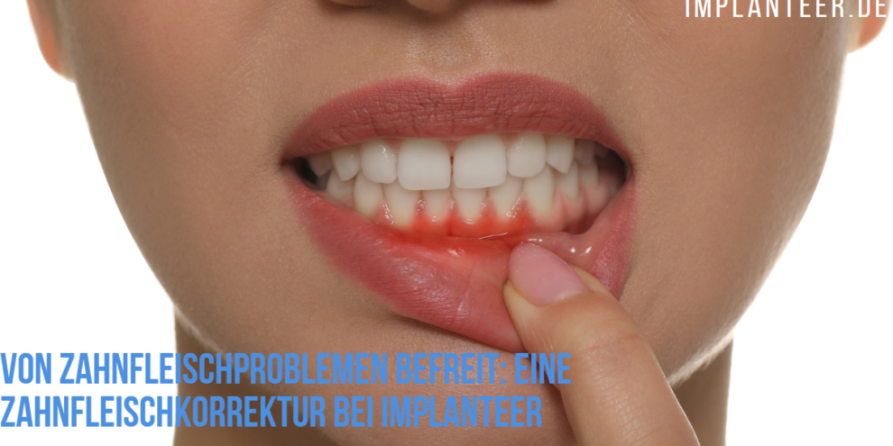 Zahnfleischkorrektur