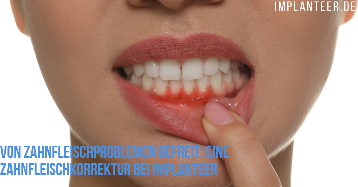 Zahnfleischprobleme Zahnfleischkorrektur
